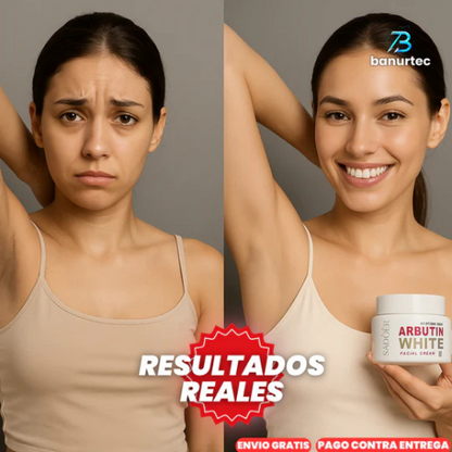 Oferta Especial: ArbutinWhite™ Crema Blanqueadora De Nicotinamida y Arbutina - G
