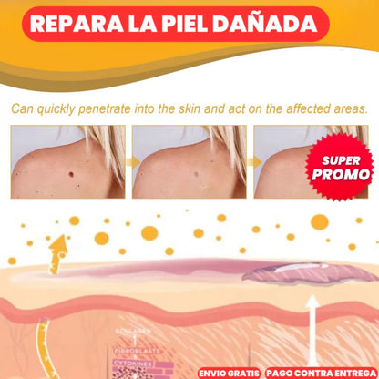 Eliminador de Verrugas Instantáneo - G