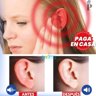TinniDrop™: Spray De Tratamiento Efectivo Alivia Dolor De Oído, Mejora La Escucha Y Cura La Sordera - G